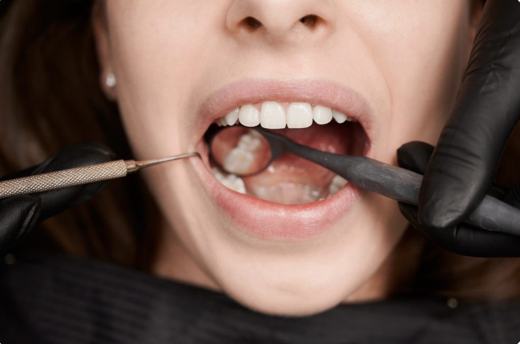 patient getting their teeth checked