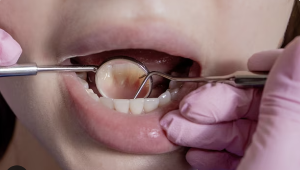 dentist checking set of teeth