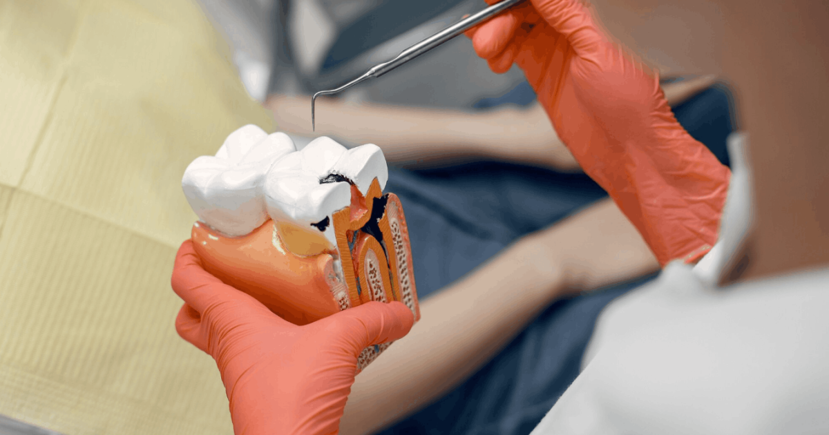 dentist showing a patient a model of a tooth with root canal
