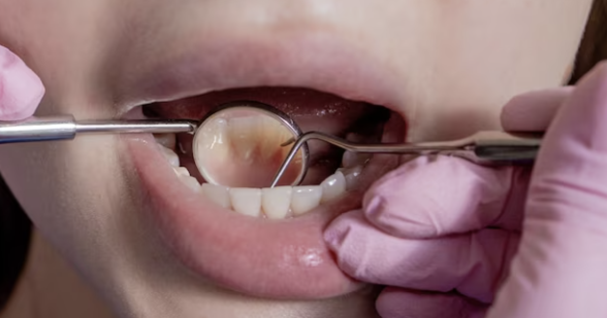 dentist checking set of teeth
