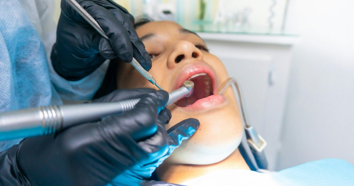 teeth-scaling-under-2mb